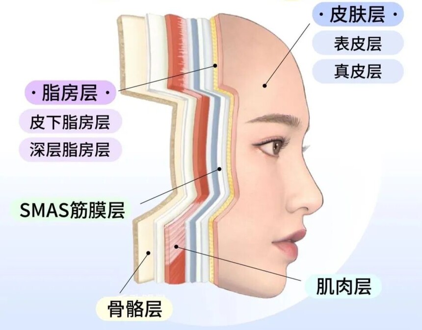 筋膜提升.jpg 筋膜提升.jpg