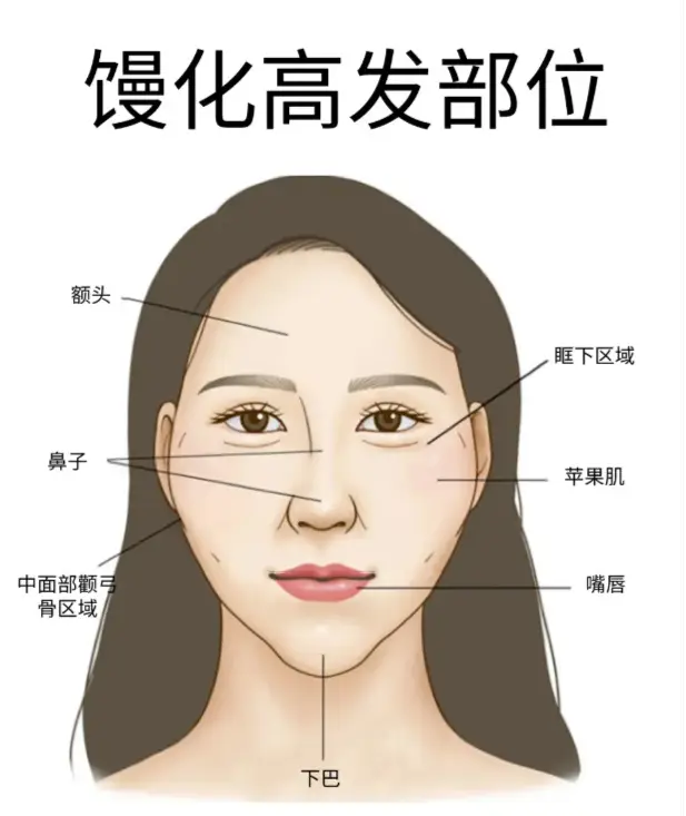 苹果肌馒化修复 苹果肌馒化修复