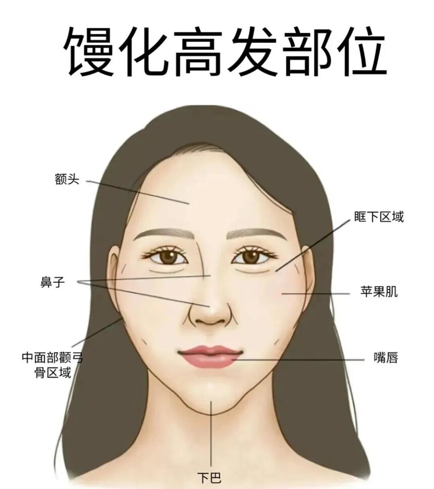 面部馒化.jpg 面部馒化.jpg