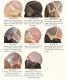 cranial prosthesis wigs