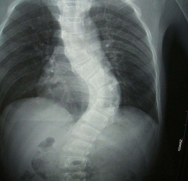95.jpg