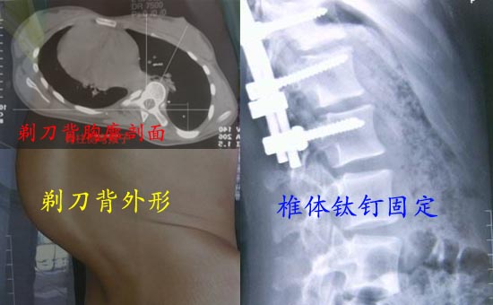 1굶-1.jpg