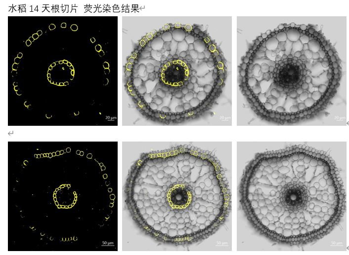 水稻14天根切片 荧光染色结果.png